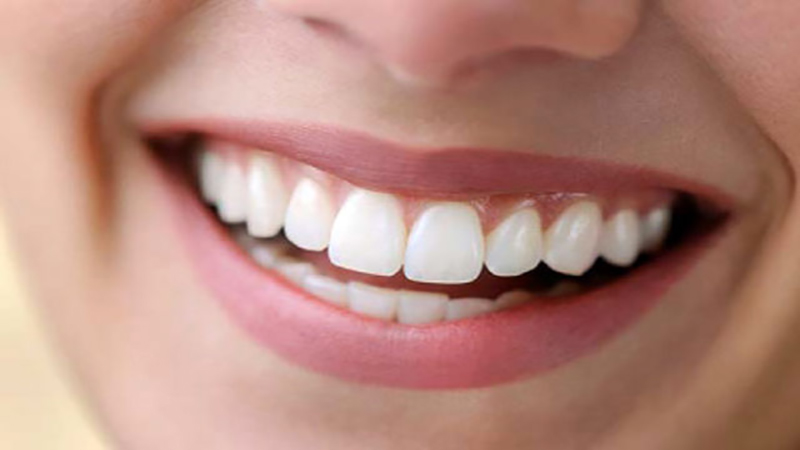 بهترین دندانپزشک اصفهان | فیسینگ دندان