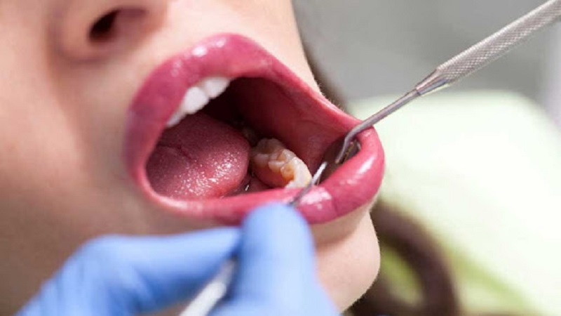 بهترین دندانپزشک اصفهان | جراحی دهان و دندان اصفهان