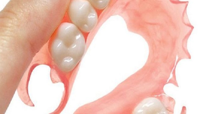 بهترین دندانپزشک اصفهان | پروتز متحرک دندان