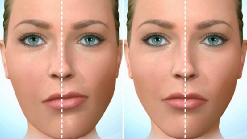 بهترین دندانپزشک اصفهان | اختلالات فک