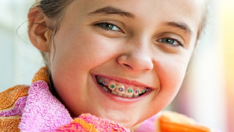 بهترین دندانپزشک اصفهان | ارتودنسی کودکان